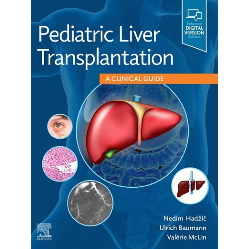 Pediatric Liver Transplantation: A Clinical Guide