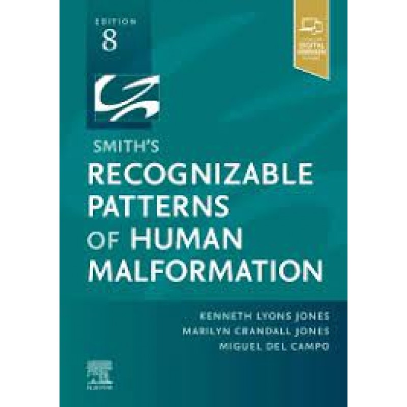 Smith's Recognizable Patterns of Human Malformation, 8E 