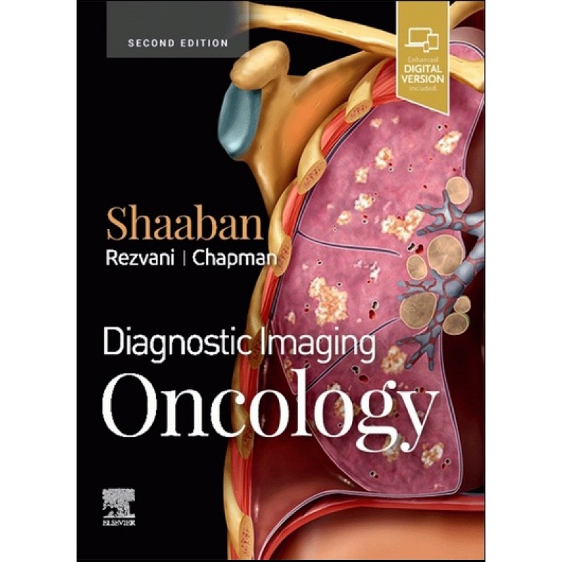 Diagnostic Imaging: Oncology 2E