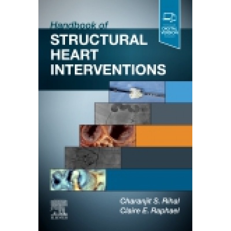 Handbook of Structural Heart Interventions