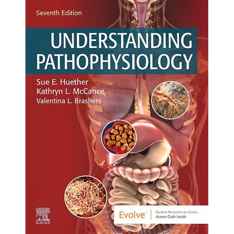 Understanding Pathophysiology, 7E