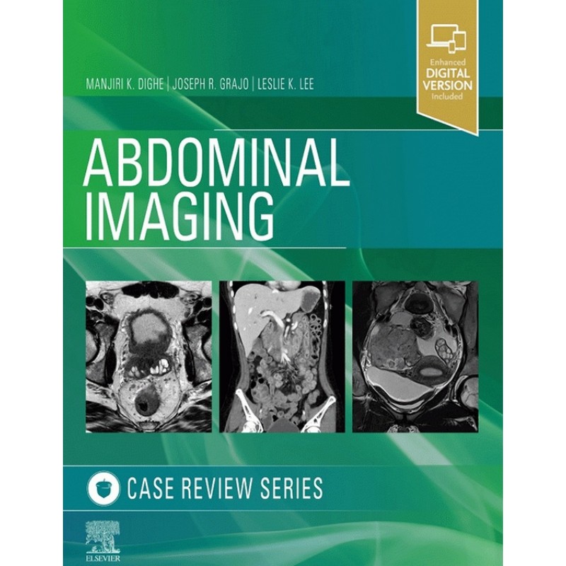 Abdominal Imaging: Case Review Series