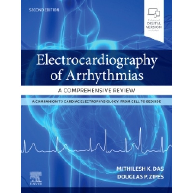 Electrocardiography of Arrhythmias: A Comprehensive Review, 2E 