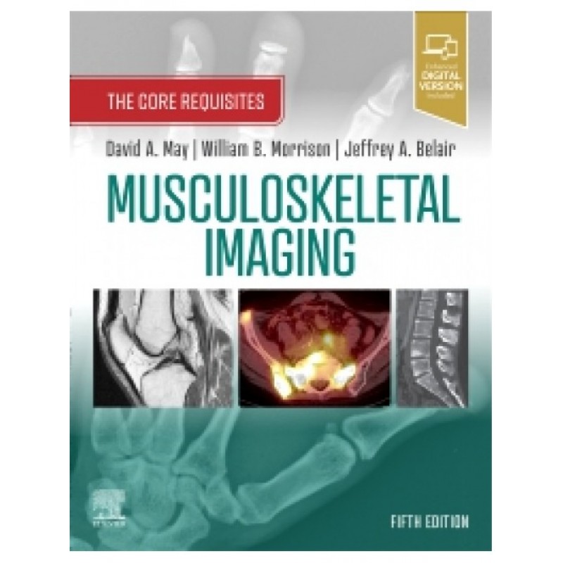 Musculoskeletal Imaging: The Core Requisites, 5E