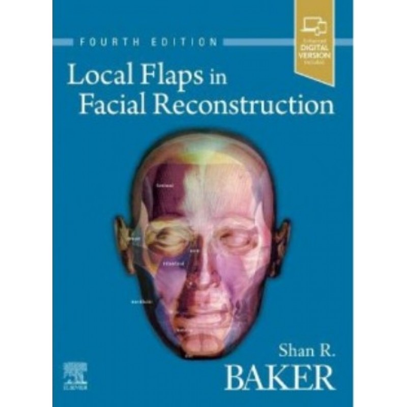 Local Flaps in Facial Reconstruction, 4E 