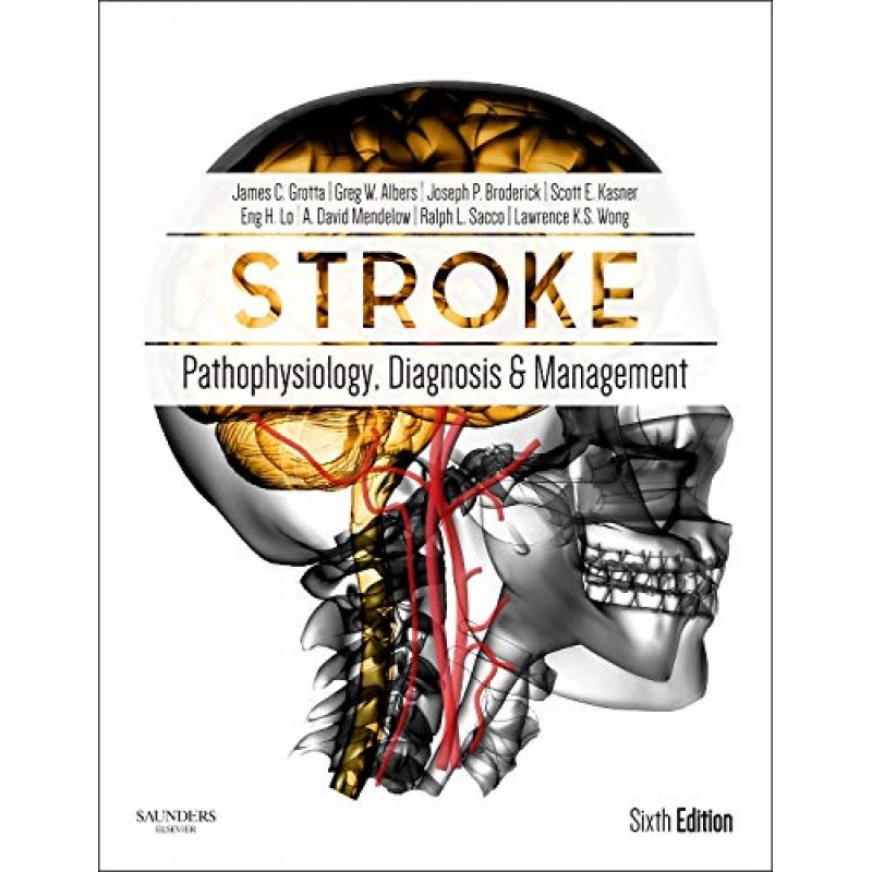 Stroke 7E: Pathophysiology, Diagnosis, and Management 