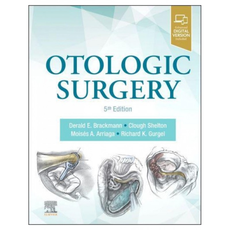 Otologic Surgery, 5E 