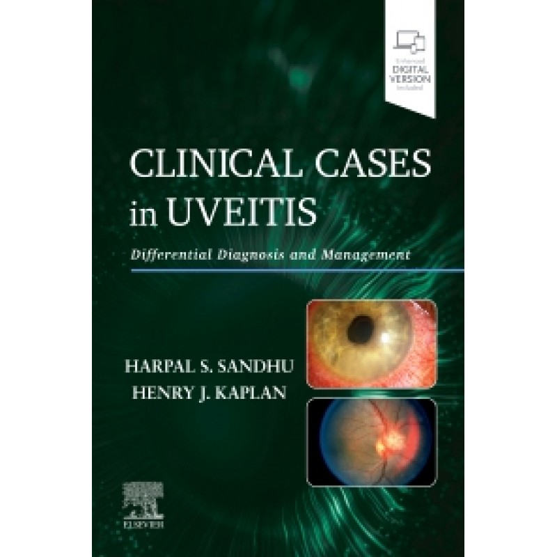 Clinical Cases in Uveitis 