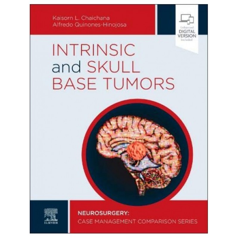 Intrinsic and Skull Base Tumors 