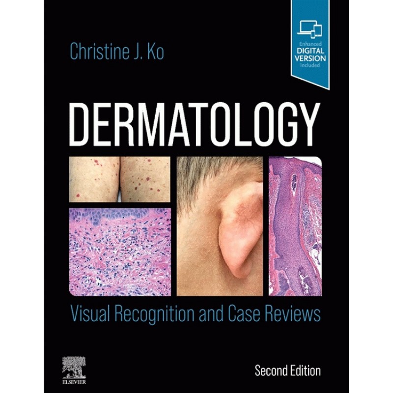 Dermatology: Visual Recognition and Case Reviews 2E