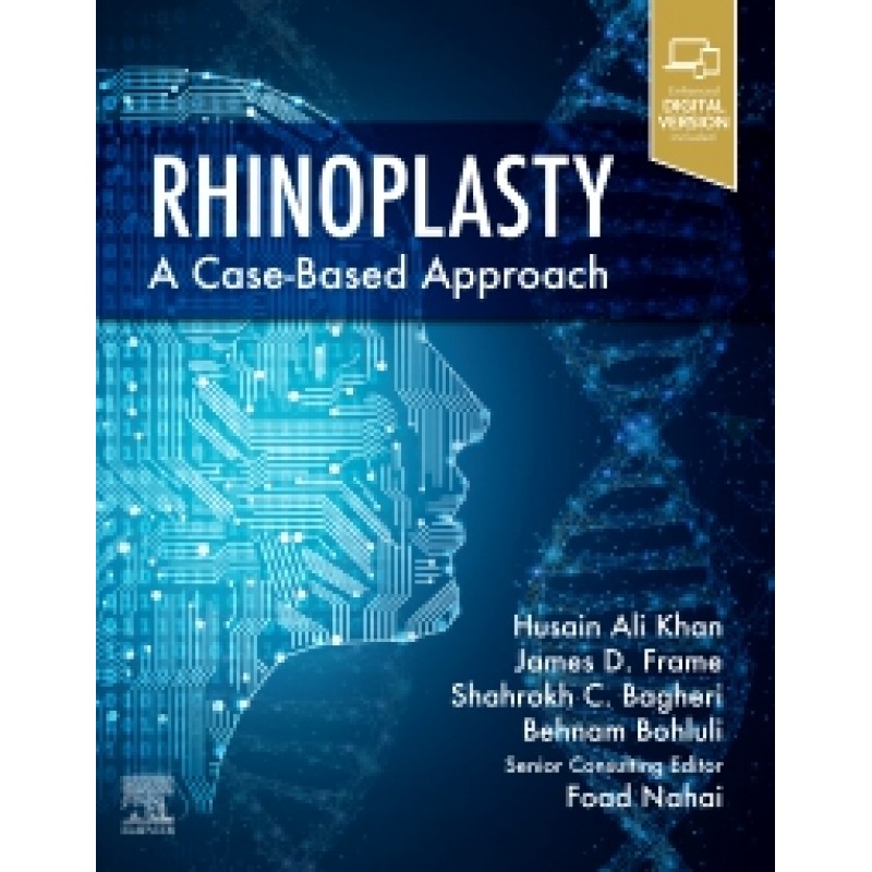 Rhinoplasty a Case-based approach 