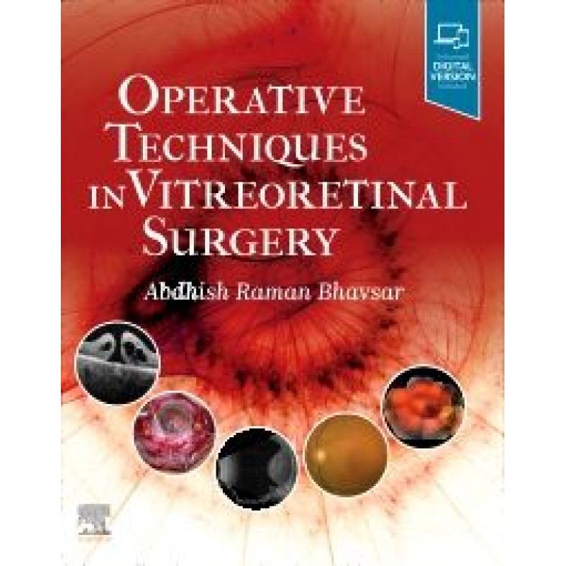 Operative Techniques in Vitreoretinal Surgery 