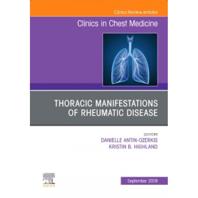 Thoracic Manifestations of Rheumatic Disease, An Issue of Clinics in Chest Medicine , Volume 40-3