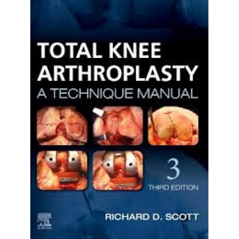 Total Knee Arthroplasty, 3rd Edition