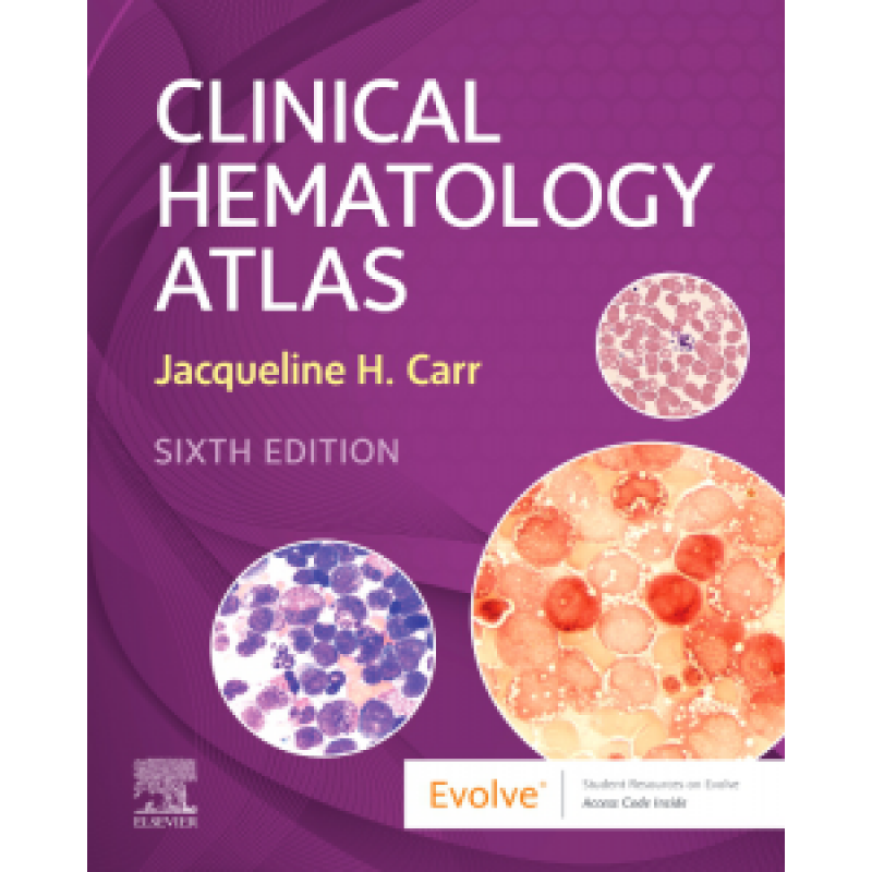 Clinical Hematology Atlas, 6E