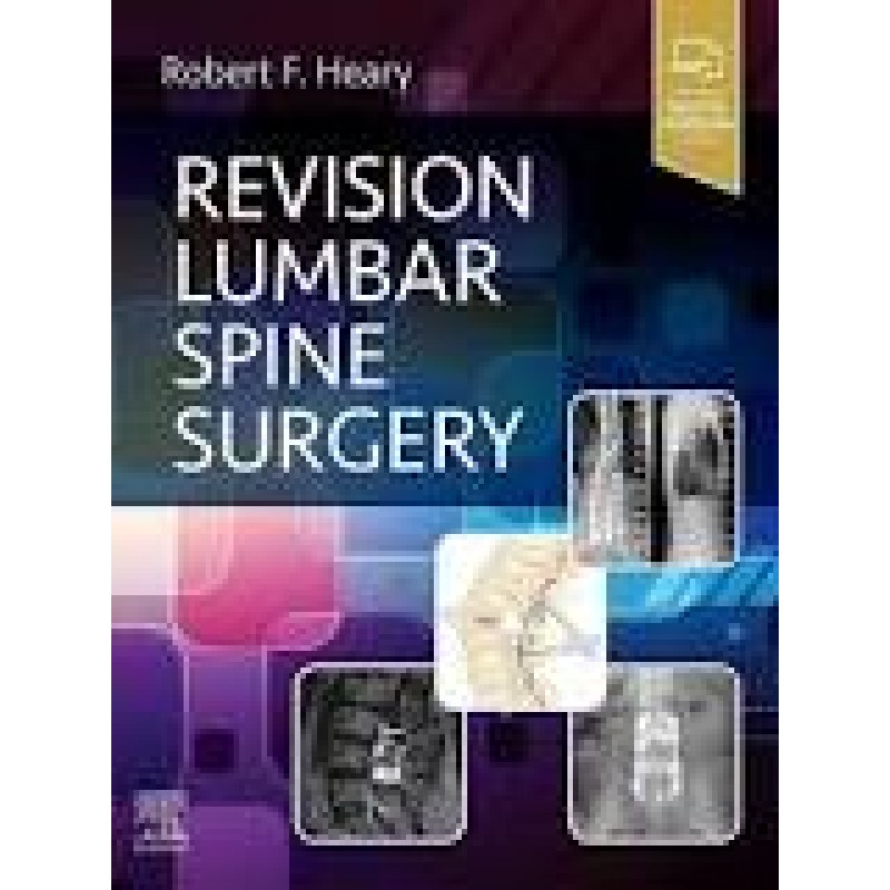 Revision Lumbar Spine Surgery By Heary 