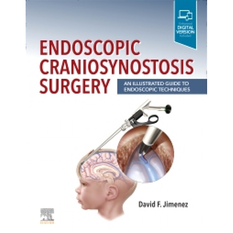 Endoscopic Craniosynostosis Surgery , An Illustrated Guide to Endoscopic Techniques 