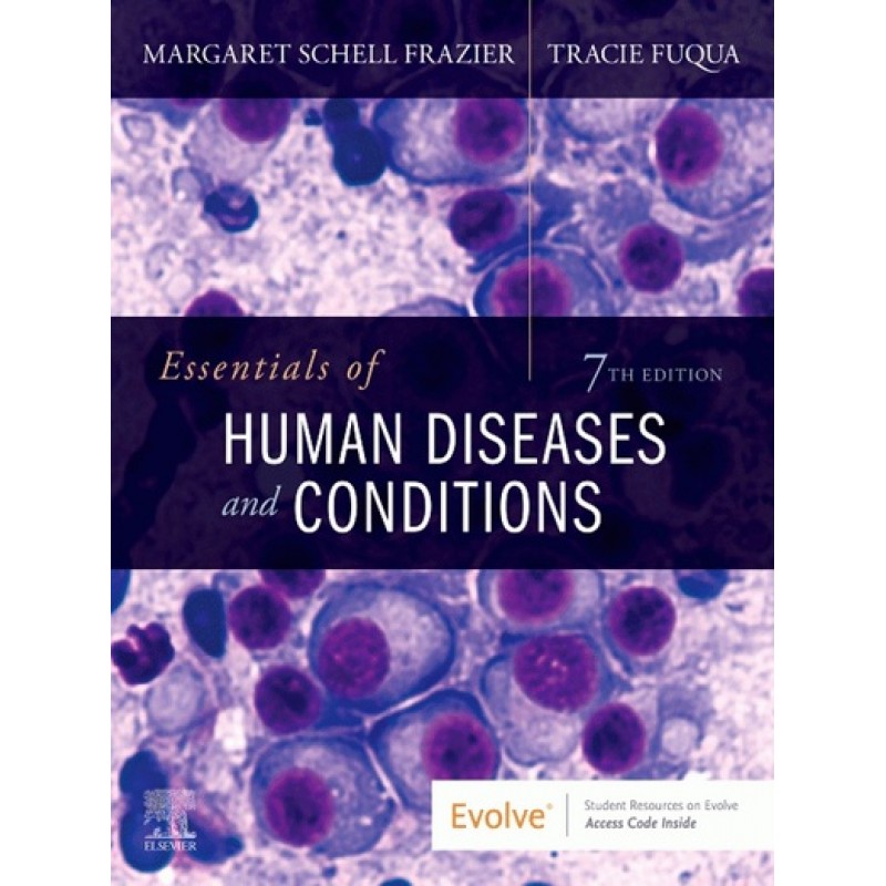 Essentials of Human Diseases and Conditions 7E