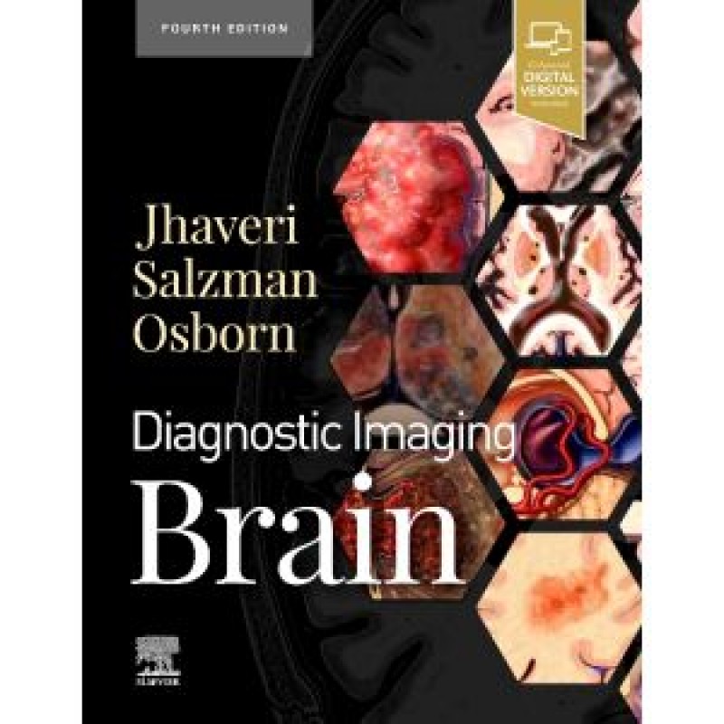 Diagnostic Imaging: Brain, 4th Edition