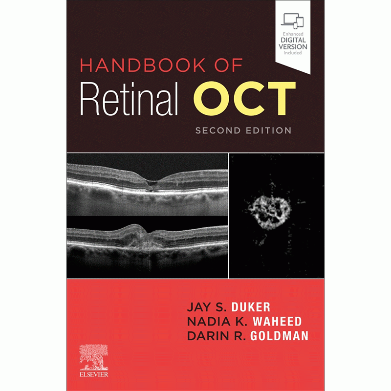 Handbook of Retinal OCT, 2nd Edition