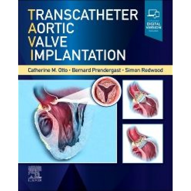 Transcatheter Aortic Valve Implantation