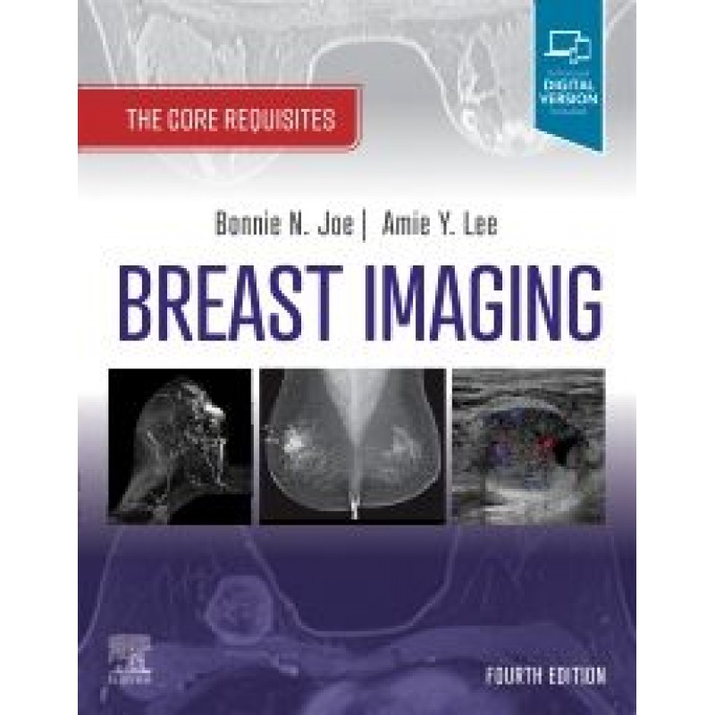 Breast Imaging, 4E The Core Requisites