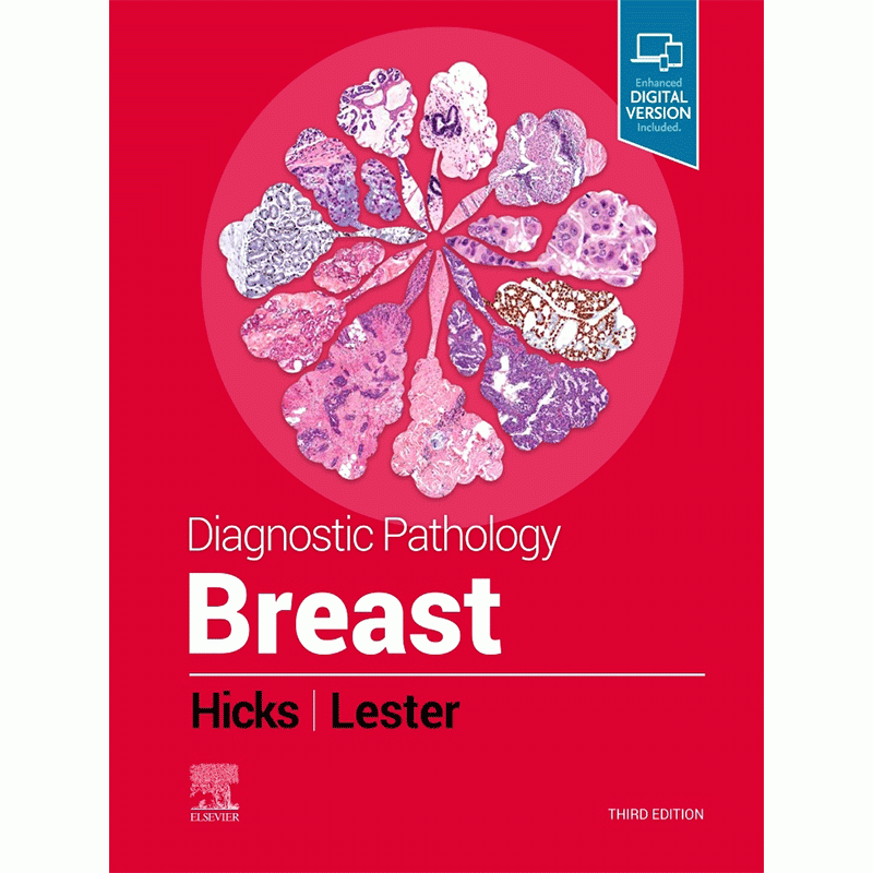 Diagnostic Pathology: Breast, 3E