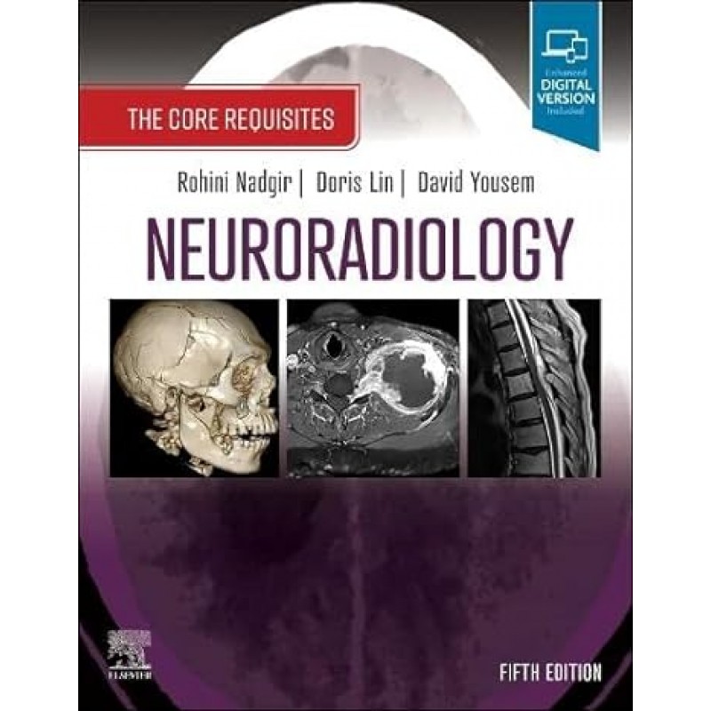 Neuroradiology: The Core Requisites 5th Edition