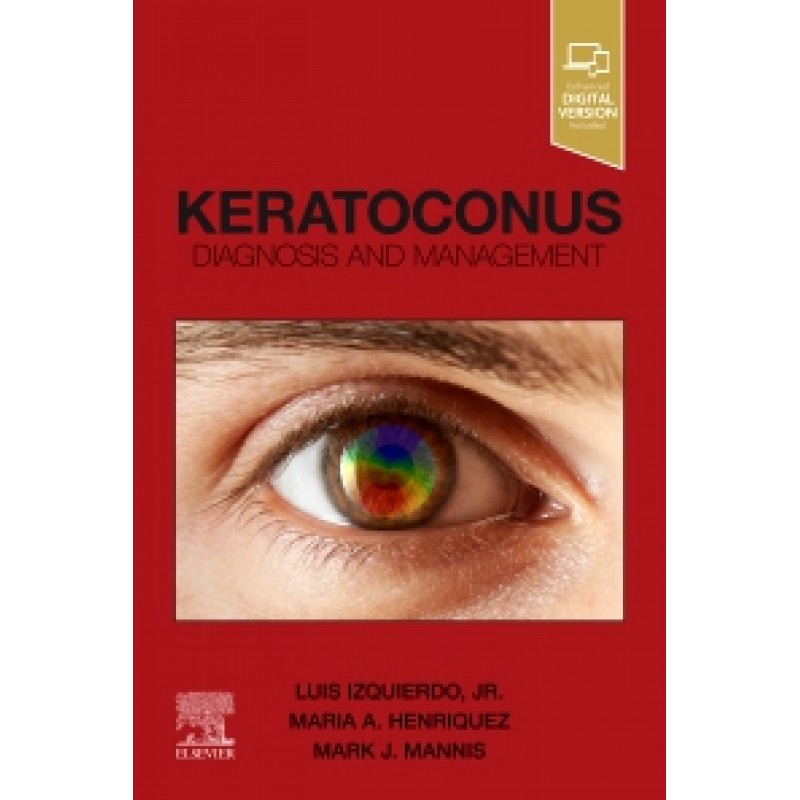 Keratoconus Diagnosis and Management 