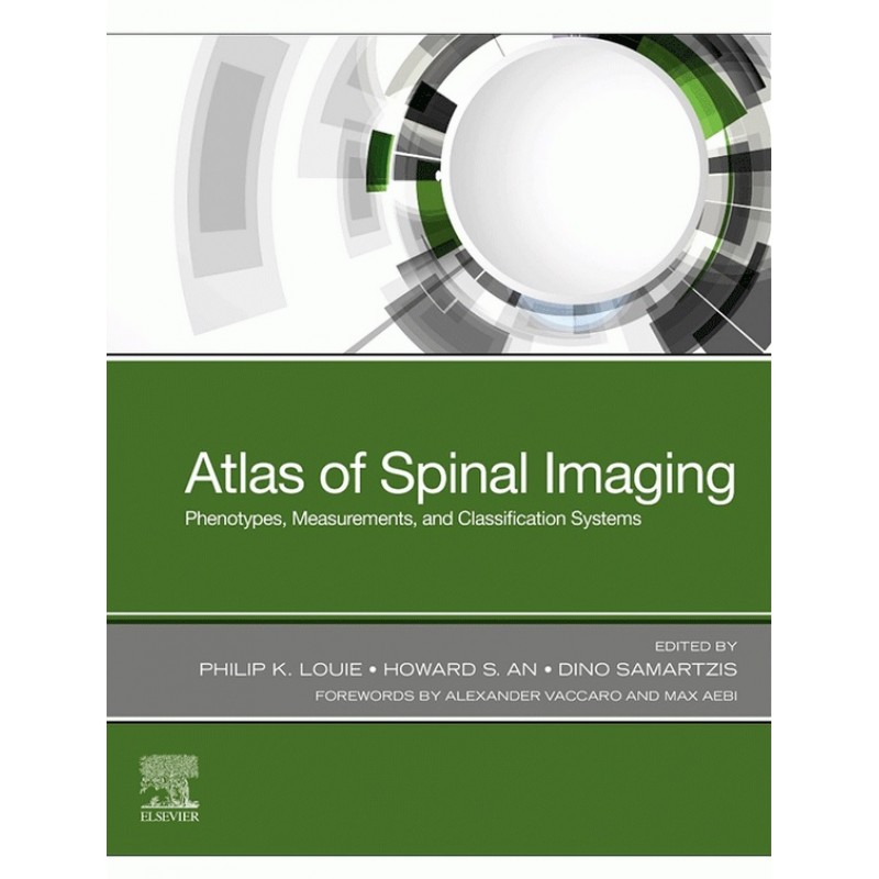 Atlas of Spinal Imaging: Phenotypes, Measurements and Classification Systems