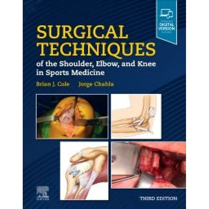 Surgical Techniques of the Shoulder, Elbow, and Knee in Sports Medicine, 3E