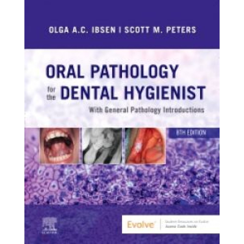 Oral Pathology for the Dental Hygienist, 8E