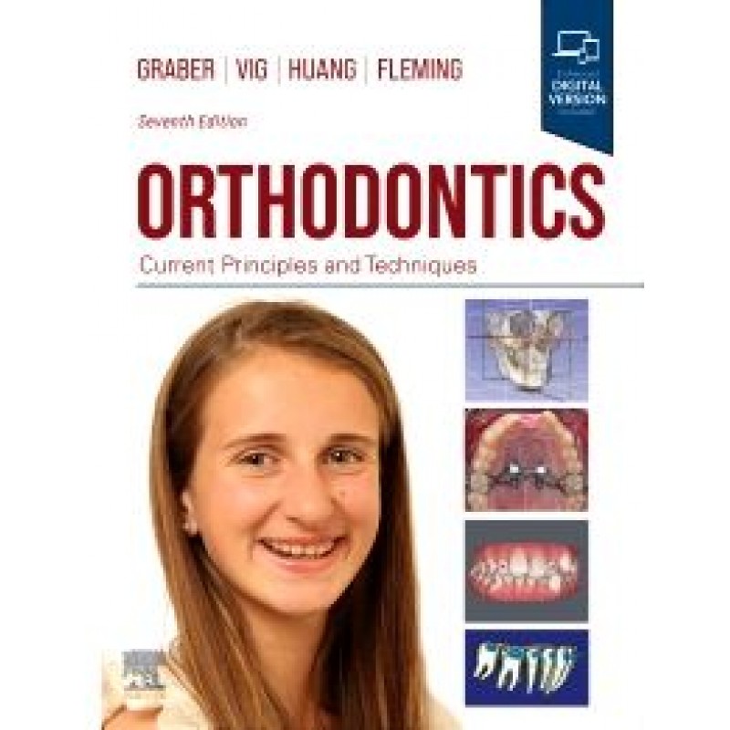 Orthodontics, 7E 