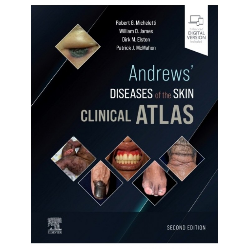 Andrews' Diseases of the Skin Clinical Atlas, 2E