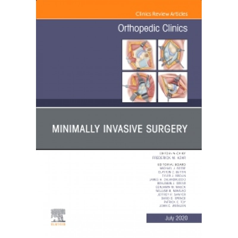 Minimally Invasive Surgery , An Issue of Orthopedic Clinics, Volume 51-3