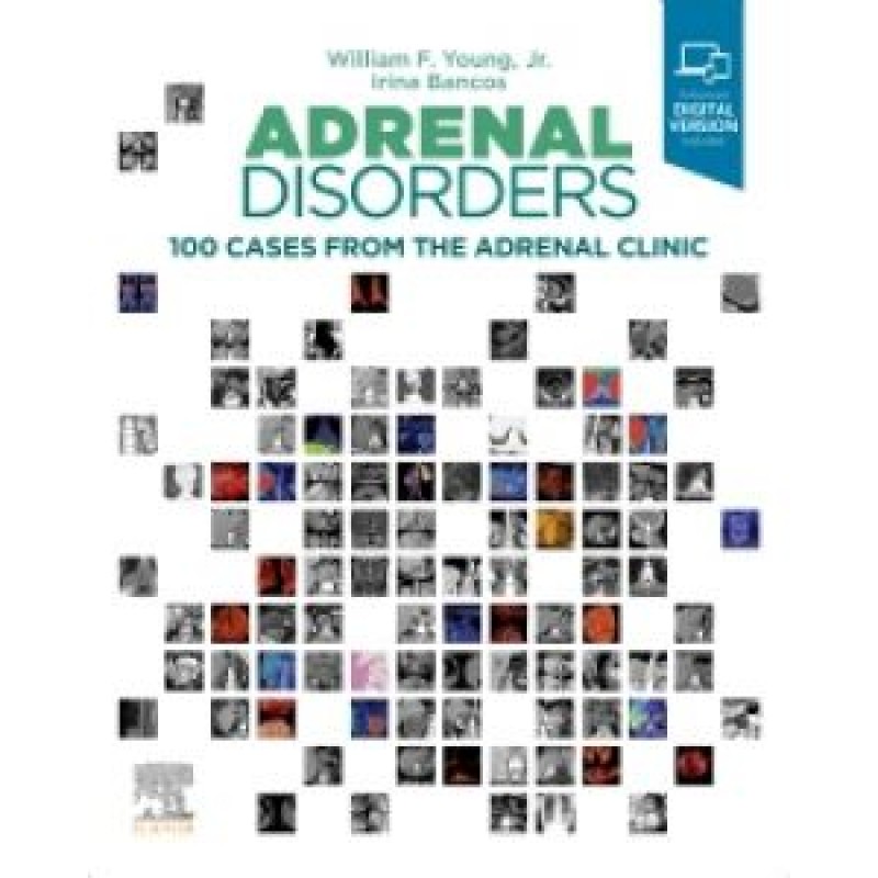 Adrenal Disorders 100 Cases from the Adrenal Clinic 