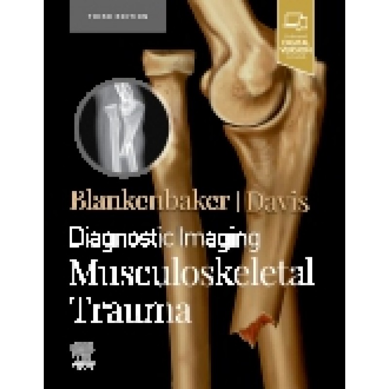 Diagnostic Imaging: Musculoskeletal Trauma 3E 