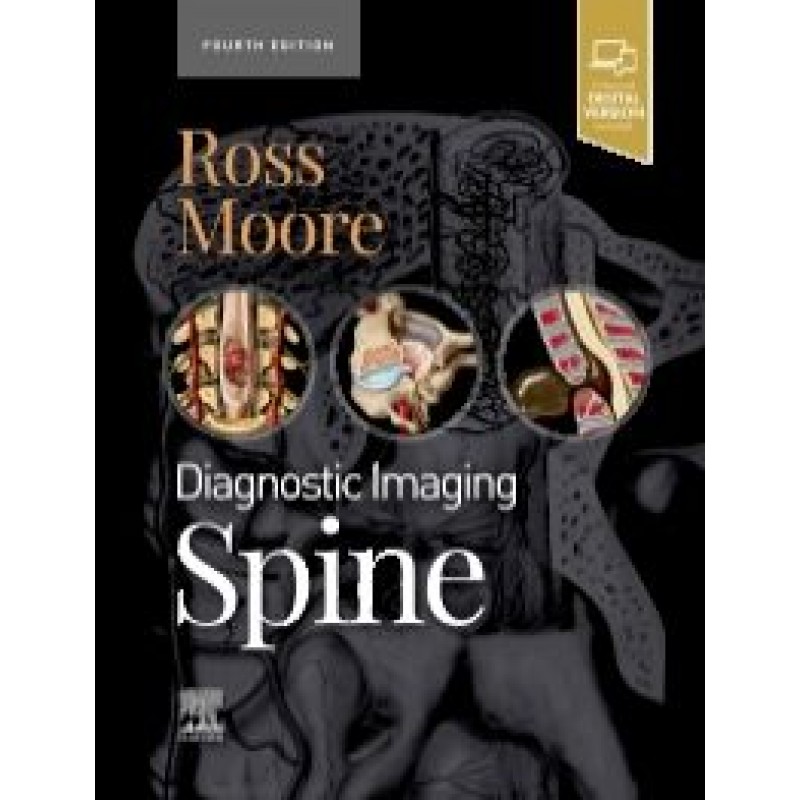 Diagnostic Imaging: Spine, 4th Edition