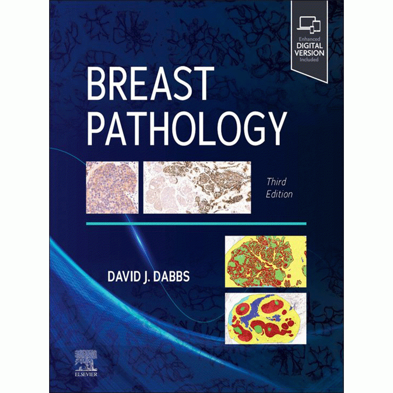 Breast Pathology by Dabbs, 3rd Edition