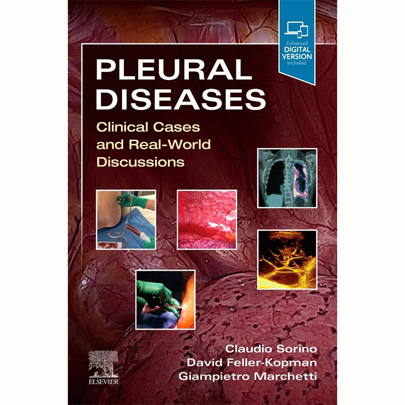 Pleural Diseases: Clinical Cases and Real-World Discussions