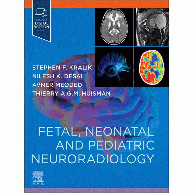 Fetal, Neonatal and Pediatric Neuroradiology