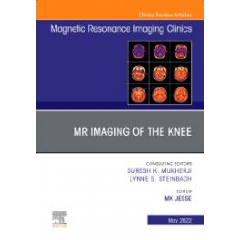 MR Imaging of The Knee, An Issue of Magnetic Resonance Imaging Clinics of North America, Volume 30-2 