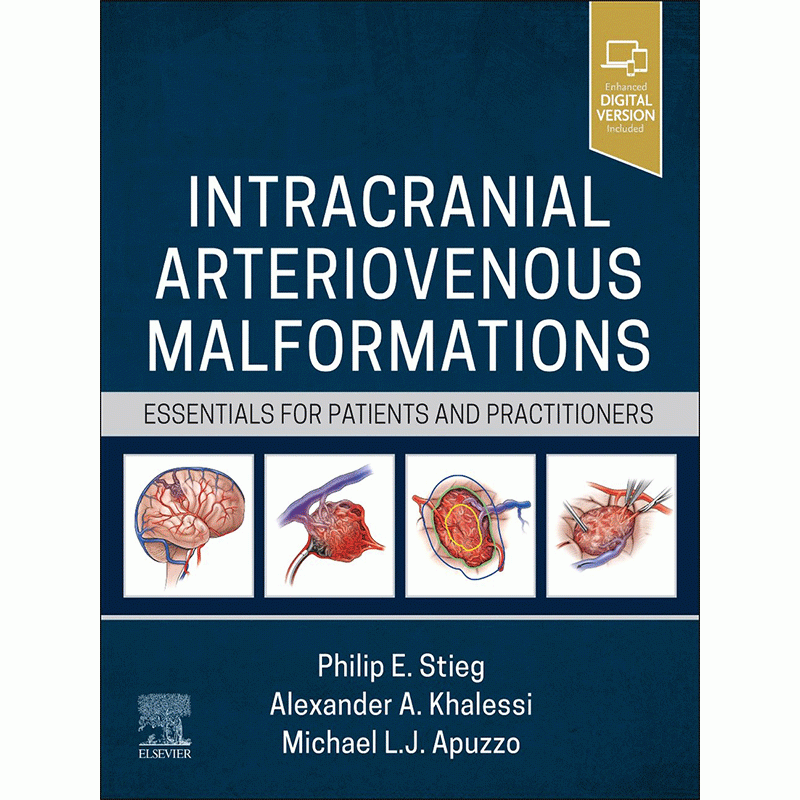 Intracranial Arteriovenous Malformations (Essentials for Patients and Practitioners)