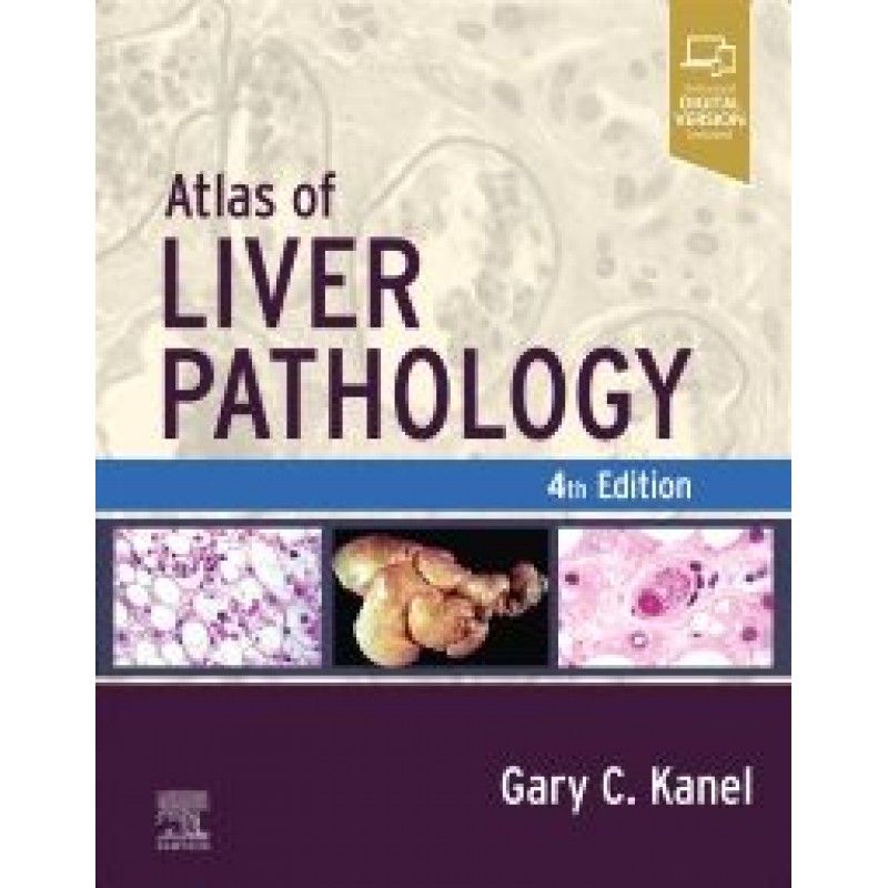 Atlas of Liver Pathology, 4th Edition