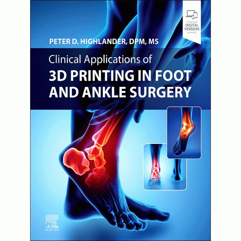 Clinical Applications of 3D Printing in Foot and Ankle Surgery