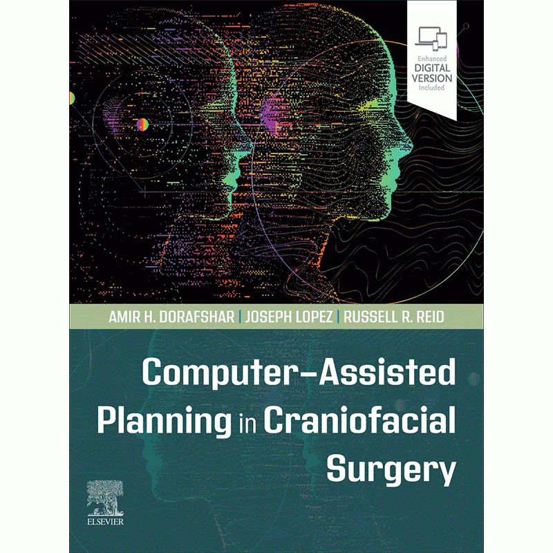 Computer-Assisted Planning in Craniofacial Surgery