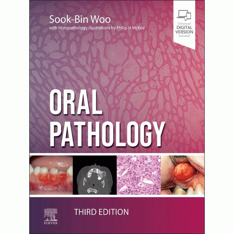 Oral Pathology, 3rd Edition