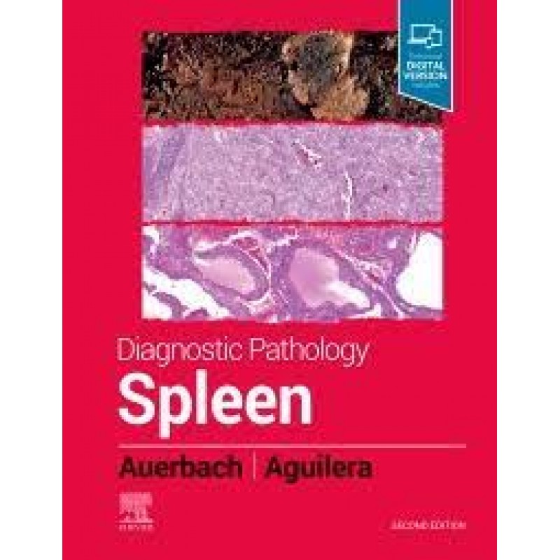 Diagnostic Pathology: Spleen, 2E 