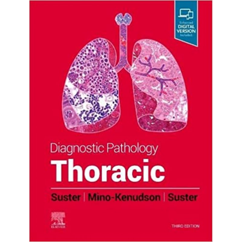 Diagnostic Pathology: Thoracic, 3E