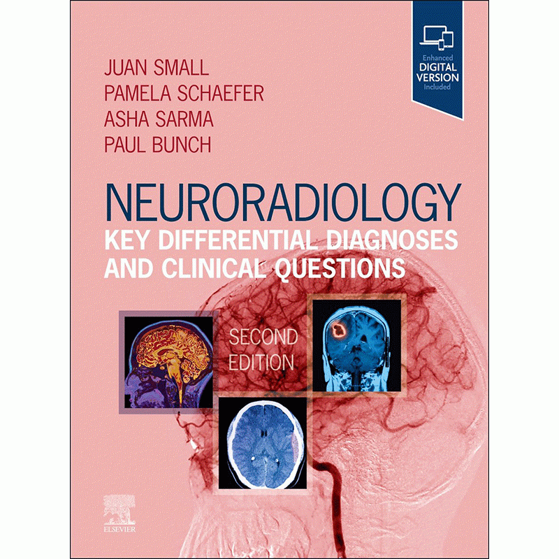 Neuroradiology: Key Differential Diagnoses and Clinical Questions, 2nd Edition